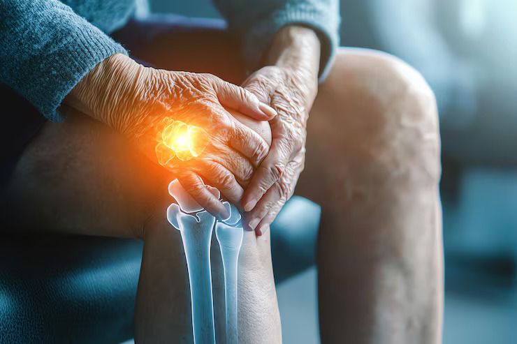 Causes and Risk Factors