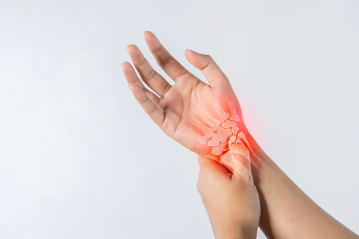 Advanced Physiotherapy Techniques for Arthritis